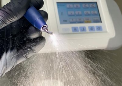 Detartraj - OralArtStudio