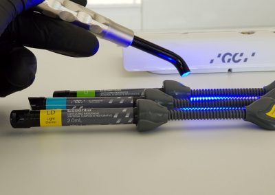 Obturatie - OralArtStudio