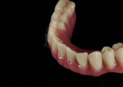 Sigilare - OralArtStudio